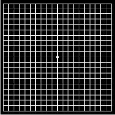 Amsler Grid Looks Like Graph Paper