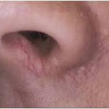 Maybe you would like to learn more about one of these? Creating Flawless Skin