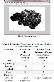 Join the aad virtually as we hike across the country. Pdf Melanoma Skin Cancer Detection By Segmentation And Feature Extraction Using Combination Of Otsu And Stolz Algorithm Technique Semantic Scholar