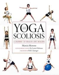 Yoga And Scoliosis A Journey To Health And Healing Scoliosis Exercises Yoga For Scoliosis Scoliosis