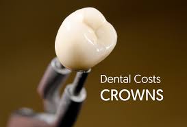 How much do dental crowns cost? Dental Crown Costs Don T Pay More Dental Aware Australia