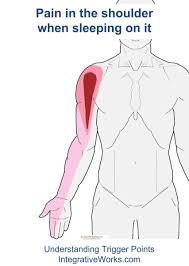 Pin On Shoulder Neck Arm Pain