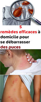 Pin On Remedes Maison