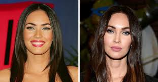 La protagonista de transformers destaca por sus curvas y el. Bichectomia Antes Y Despues De Las Famosas Que Se Sometieron A Esta Cirugia Vix