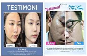 Ms Glow Spot Treatment