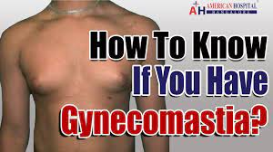 How to know if you have gyno. How To Know If You Have Gynecomastia 5 Gynecomastia Symptoms Youtube