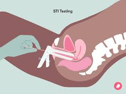 Image result for chlamydia symptoms