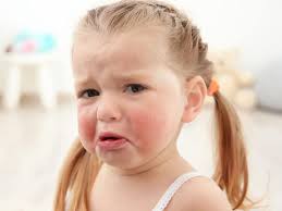 My children don&apost have food allergies. Food Allergies In Kids Symptoms Testing Tips And Advice