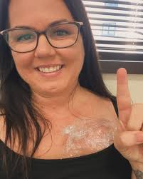 Breast Cancer Treatment and Support