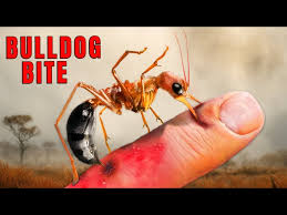 Image result for ant bite
