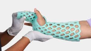 Image result for Radial Gutter Cast