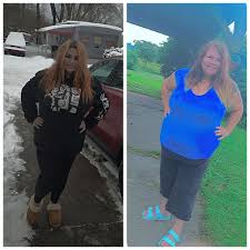 Down 80 pounds since July this has really changed my life for the better  losing weight a little slower now because I can't walk but still  losing.Weight