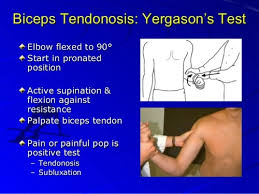 Image result for Yergason Test