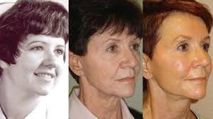 Amy Verzaal's Instagram, Facebook & TikTok