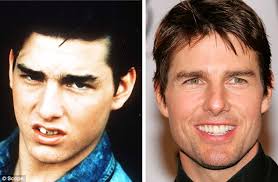 Tom cruise has always been known to have arguably the best hollywood smile that leaves people dying with jealous. Stars Who Ve Brushed Up Their Smiles Image With Gleaming New Teeth Daily Mail Online