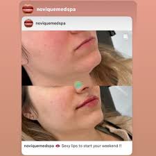 Jill Nahill RN, BSN (@jill.rninjector) • Instagram photos and videos