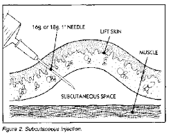Image result for Subcutaneous Injection