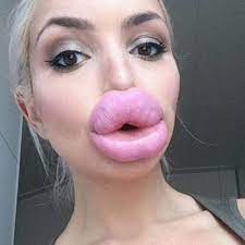 Lip fillers porn