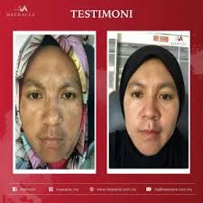 Dengan kata lain kesan atau pendapat kita tentang sekolah. Info Meeracle Gemstone Skincare Testimoni Kosmetik Cida