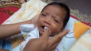 Bisa jadi si kecil terkena thrush yang merupakan infeksi jamur yang umum terjadi pada perhatikan juga bila terlihat bercak putih di mulut si kecil dan anda mencurigainya sebagai thrush. Cara Membersihkan Lidah Bayi Youtube