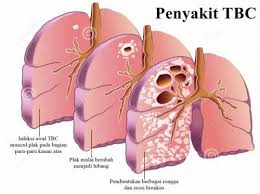Check spelling or type a new query. Berbagi Ilmu Pengetahuan Batuk Dan Gejalanya