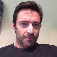 Hugh Jackman Treated for Skin Cancer