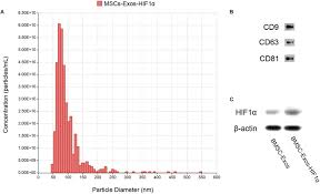 The expressions below are all covered in the tutorial above and you can simply copy/paste them to your project! Frontiers Bmsc Exosomes Carry Mutant Hif 1a For Improving Angiogenesis And Osteogenesis In Critical Sized Calvarial Defects Bioengineering And Biotechnology
