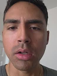 foryou #foryoupage #fypシ #chavesstery