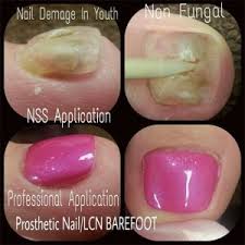 Since 1878, women have been getting their nails done in the us at various salons and parlors. Acrylic Overlay On Toes Nail And Manicure Trends