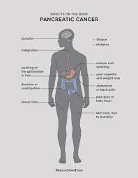 Some people with pancreatic cancer manage to beat the odds, surviving for many years after their initial diagnosis — maybe even long enough for doctors to use the word. Pancreatic Cancer Symptoms Causes And Treatment