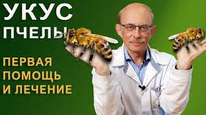 как снять отек от укуса осы в домашних условиях Ukus Pchely Chto Delat Kak Snyat Opuhol Opasnye Simptomy Allergiya Youtube