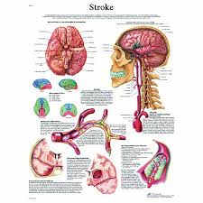 Anatomical Chart Stroke Chart Paper Products Medical