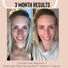 Travel Skincare Tips: Hydrate, Sunscreen, Exfoliate