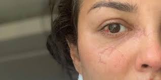 كشفت أيضا عن جنسية والدتها وأنكرها لها، وعن ديانتها في حلقة مثيرة للجدل. Ø´Ø§Ù‡Ø¯ Ù„Ø£ÙˆÙ„ Ù…Ø±Ø© Ù†Ø§Ø¯ÙŠÙ† Ù†Ø³ÙŠØ¨ Ù†Ø¬ÙŠÙ… Ù‚Ø¨Ù„ ÙˆØ¨Ø¹Ø¯ Ø§Ù„Ø§Ù†ÙØ¬Ø§Ø± Ø¯Ù†ÙŠØ§ Ø§Ù„Ù…Ø´Ø§Ù‡ÙŠØ±