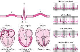 However, once you know the difference between an ecg and an ekg, you'll be well on your way to discovering what makes them increasingly valuable tools for device manufacturers that want to create. Figure Ekg Auswertung Der Kurven Msd Manual Ausgabe Fur Patienten