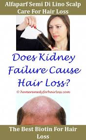 There isn't any scientific evidence to support those claims, says ginger king, a. Hair Loss Herbs For Hair Loss Rosemary Patanjali Products For Preventing Hair Loss Cb 03 01 Hair Loss Hair Lo Hair Loss Men Herbs For Hair Hair Loss Specialist