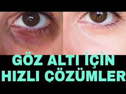 Gozalti Morluklari Gozalti Torbalari Icin Dogal Ve Hizli Cozum Dogal Bakim Dogal Guzellik Diy Youtube Guzellik Organik Cilt Bakimi Ev Yapimi Cilt Bakimi
