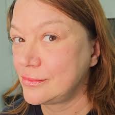 3 bölgeye Botox bir de 1 ml dudak dolgusu ile değişim! Transforming beauty  in the heart of London! 💫 Witness the stunning before and after of our  fabulous client who indulged in the magic of 3 areas ...