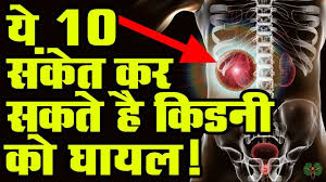 Main Symptoms Of Kidney Problems In Hindi Causes Of Kidney Disease Causes Of Kidney Disease Kidney Disease Kidney Disease Symptoms