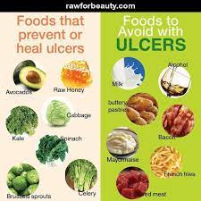 2 to 3 teaspoons daily mixed in a glass of clean filtered water will do the trick (taken on an empty stomach). 11 Peptic Ulcer Recipes Ideas Peptic Ulcer Gerd Diet Ulcer Diet