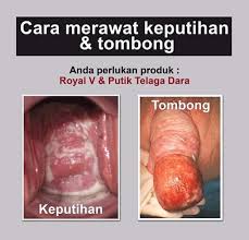 Kumpulan gambar lucu banget yang kocak dan paling unik (bergerak, animasi kartun, kata kata bahasa jawa. Apa Itu Penyakit Tombong Jrm Holistik By Najrm Facebook