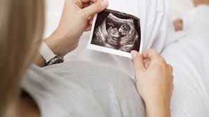Live beim ultraschall | sie muss wieder kotzen. 15 Ssw Schwangerschaftswoche Onmeda De