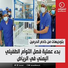 غداً إجراء عملية فصل التوأم الطفيلي اليمني حيث تستغرق العملية الجراحية قرابة 8 ساعات ونصف. Y7yasklq2a6gwm