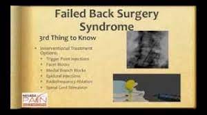 Failed Back Surgery Syndrome Physiopedia