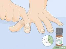 3 Ways To Get Rid Of White Spots On Your Nails - Wikihow