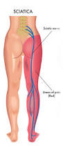 Image result for free pics of sciatic nerve