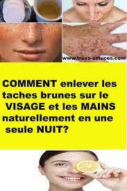 Comment Enlever Les Taches Brunes Sur Le Visage Et Les Mains Naturellement En Une Seule Nuit Trucs Astuces Mirrored Sunglasses Sunglasses Glasses
