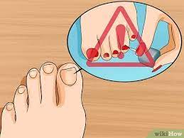 Identifying the cause of thick toenails is vital to finding the proper treatments that return them to typical. 3 Ways To Get Rid Of Yellow Toenails Wikihow