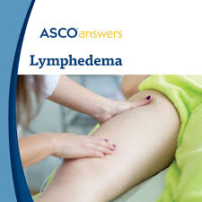 Cp/cpps is the most common type of prostatitis. Lymphedema Cancer Net