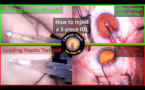 See screenshots, read the latest customer reviews, and compare ratings for canon inkjet print utility. How To Inject A 3 Piece Iol When The Haptics Twist Cataract Coach